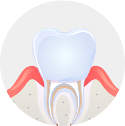 금으로 형성한 치아 머리